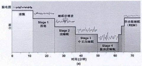 睡眠周期分为四个阶段：入睡、浅睡、深睡、快速眼动